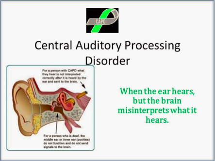 central auditory processing disorder (CAPD) Diagram